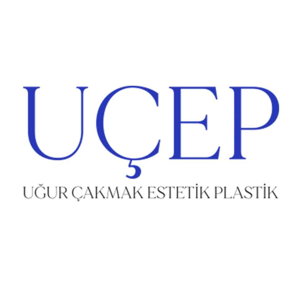 Uçep